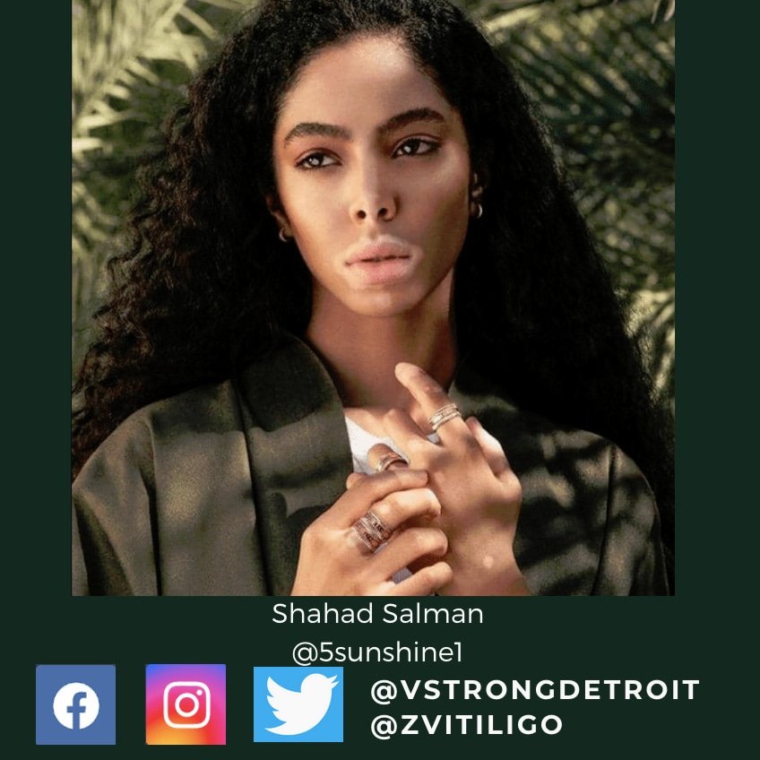 Y'all meet Shahad Salman <a href="/5sunshine1/">ت</a> on Instagram. An Arab model who is now storming the fashion industry by bringing in a new era of representation all over the world. Inspired by Winnie <a href="/winnieharlow/">♔Winnie Harlow♔</a> Salman starred on the cover of Vogue Arabia <a href="/voguearabia/">Sarah El Kays</a> in 2019.
 #vitiligo