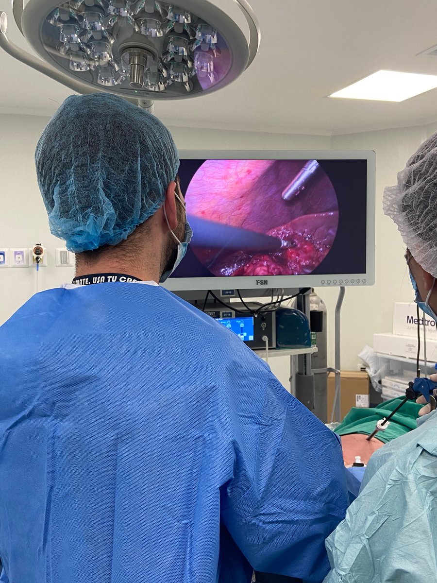 Our ex-simulation fellow, Dr Cristian Jarry, operating on a Parkland V Acute Cholecystitis 👏🏼👏🏼👏🏼 <a href="/SimulacionUC/">SimulacionUC</a> <a href="/gaboescvi/">Gabriel Escalona Vivas</a> <a href="/LappSurgery/">Lapp.surgery</a> <a href="/SAGES_Updates/">SAGES is in Tampa in 2026!</a>
