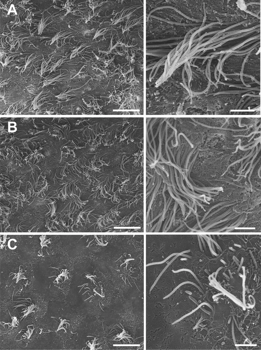 HugoGuerreroLab's tweet photo. How do #GBM cells disrupt the #SVZ? @emilynorton295 tells us more about it on her new publication. Congratulations on your paper Emily! And thank you to all the collaborators! @DoctorQMd @BeachedWhaley_ @MontLara_ @majoseun @MayoClinicNeuro 
https://t.co/0blQsCNCiU https://t.co/SlxIFZZMKY