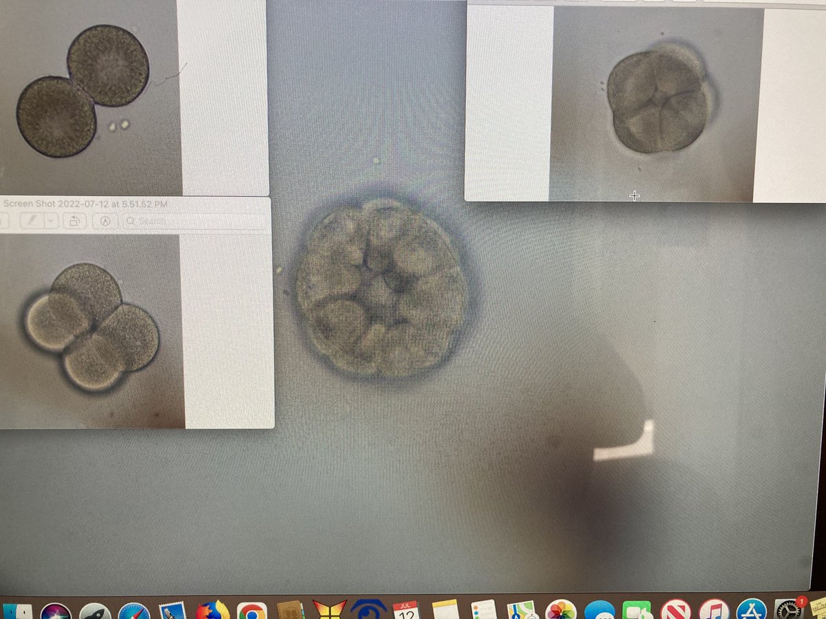EvoDevoDiva's tweet photo. Beautiful nemertean embryos in our last week ⁦@MarineBiol_FHL⁩ #EvoDevoEmbryo ⁦@UW⁩ From fertilization to gastrulation in one day, 2, 4, 8 cell and a blastula embryo shown here. Two polar bodies and gorgeous spiral cleavage!! Just waiting for gastrulation……… https://t.co/jahAXOxEFg