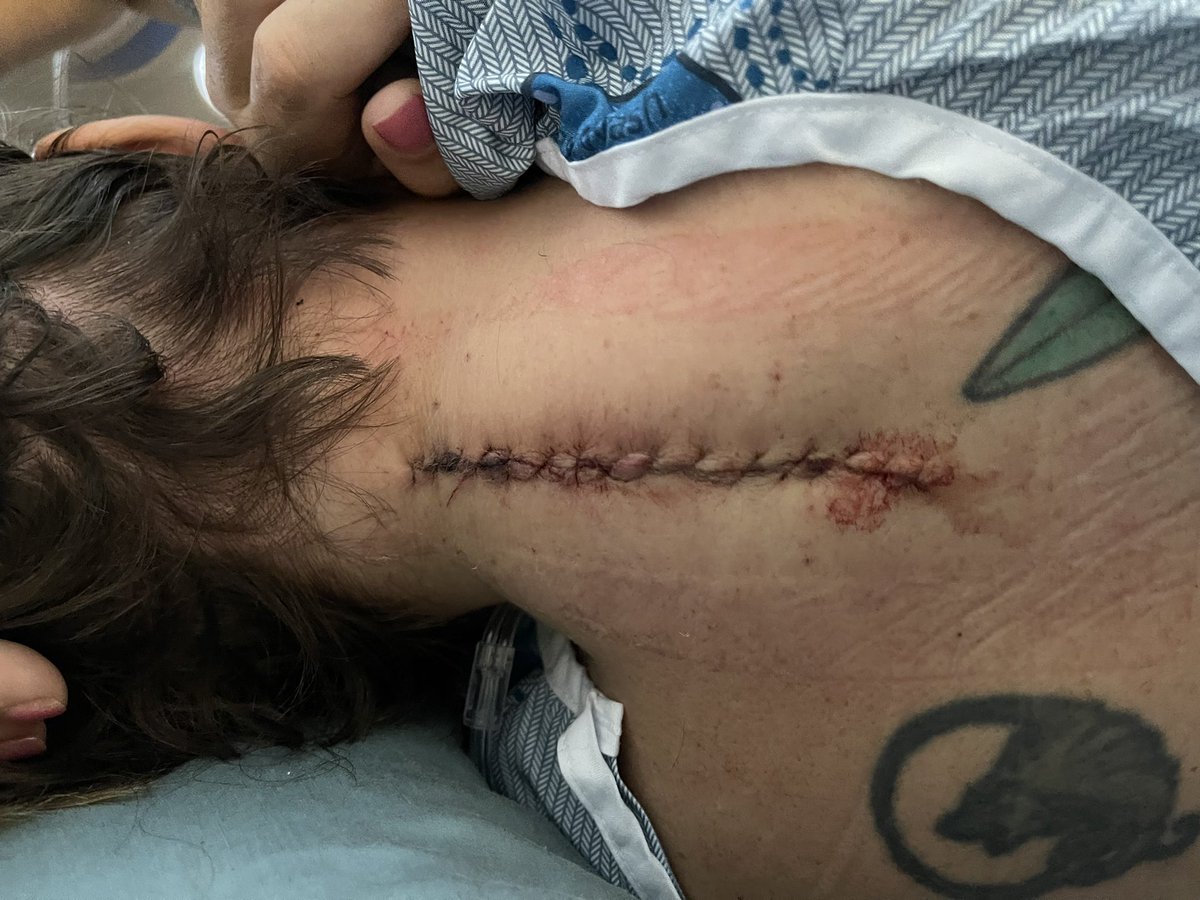 freighthauler57's tweet photo. This is my wife’s second spinal cord surgery this year. It’s sad that she can’t be working as a registered nurse considering the shortage. Not to mention the financial strain on our family. All prayers appreciated. https://t.co/wNbgpyhkXu
