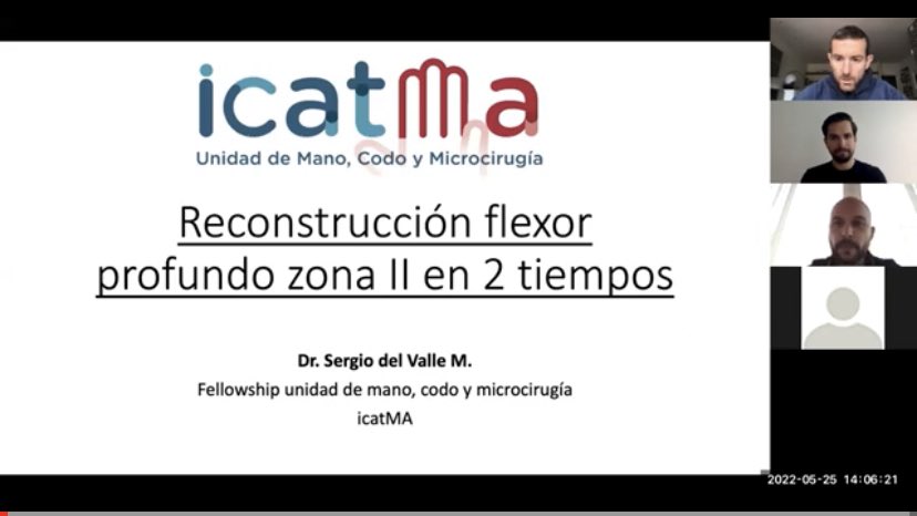 Nuevo Vídeo en el Canal de YouTube!
▪️Reconstrucción tendón flexor en 2 tiempos 
▪️Dr. Sergio del Valle M. (Chile) youtu.be/z4zdspoYXUI via <a href="/YouTube/">YouTube</a>