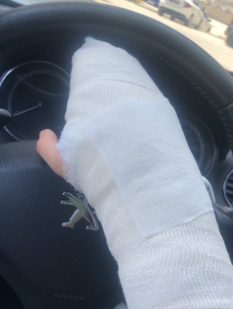 Bilin bakalım uykusunda kim parmağını kırdı