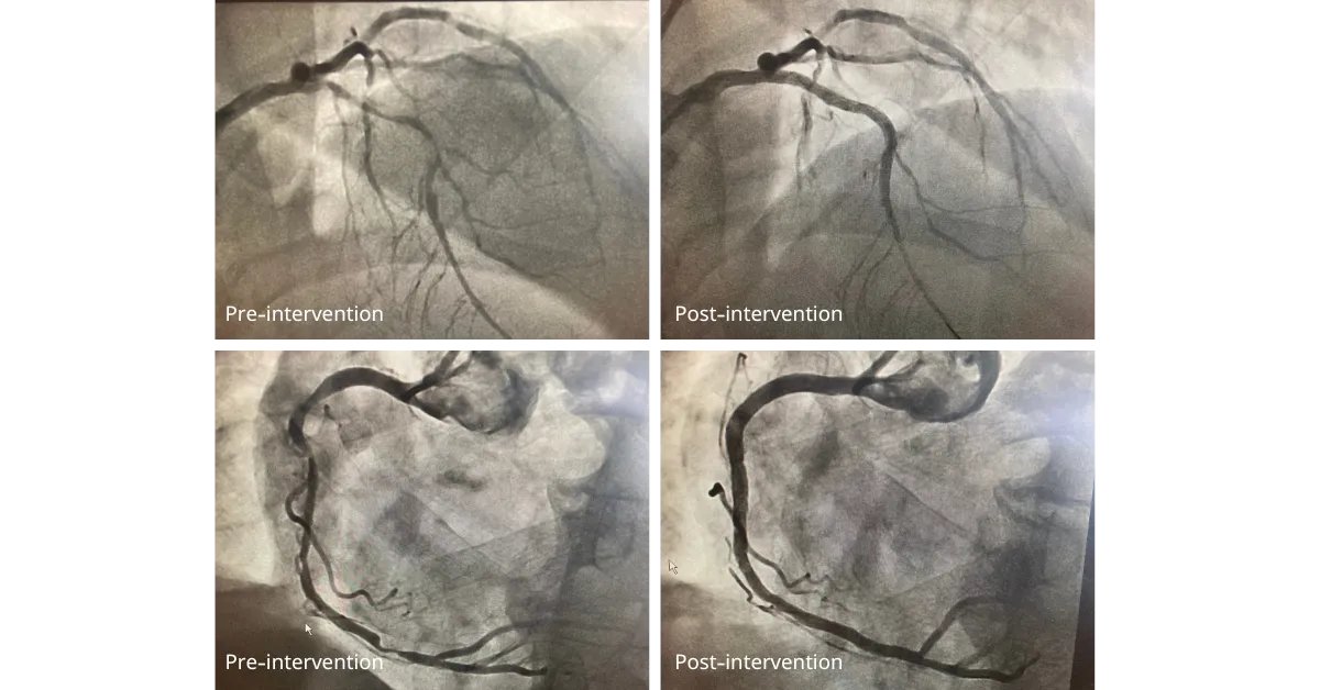 OrbusNeich Medical Company Ltd. tweet media