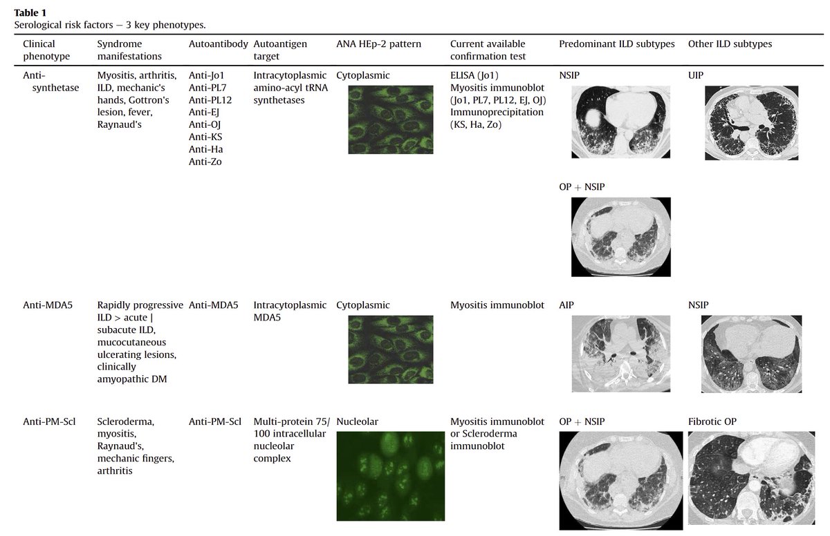 Pleased to share our review Management of #Myositis #ILD practical guide for clinicians #Teamwork ✍️💪 @docrota 🇺🇸 🖐️ @DrJoPorter 🫁 @drharsha_gunawa 🖐️ OpenAccess😃 sciencedirect.com/science/articl… 3 clinico-serological phenotypes 1⃣ anti-synthetase 2⃣ anti-MDA5 3⃣ anti-PM-Scl /1