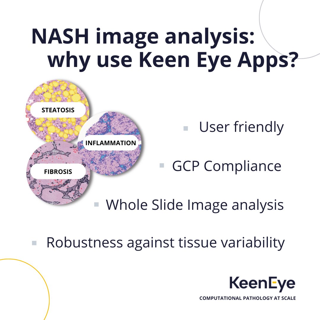 Keen Eye tweet media