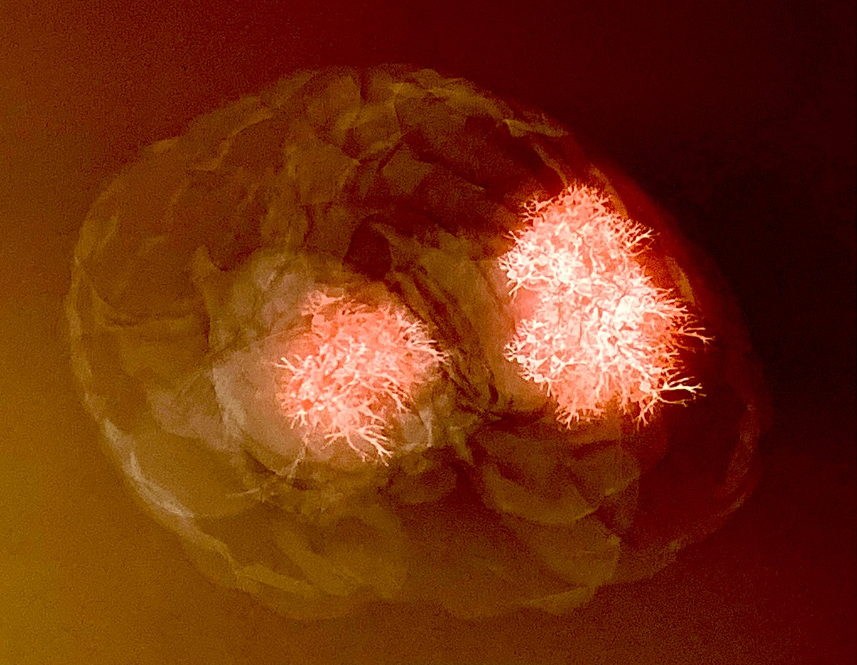 Concha Peiró tweet media