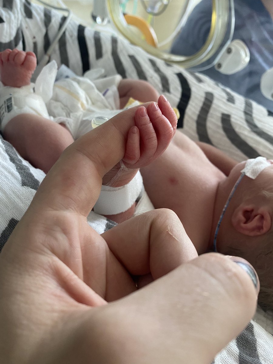 Welcome 👶🏼 Gabriel Kemp ❤️💙

Born 23:03 at 3lb 3oz

🤞🏻 We hope you have the strength of your sister x