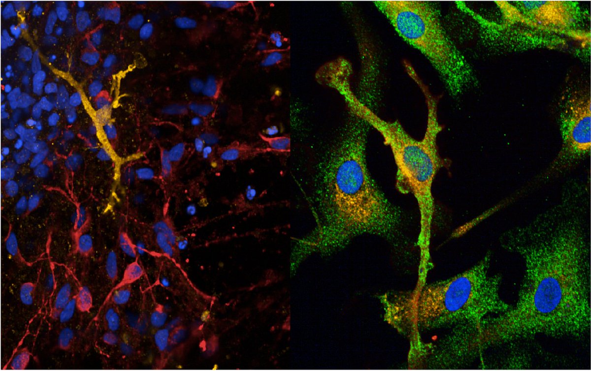 📢 Excited to say we have two funded PhD studentships to join my team at the UK DRI in Cardiff. If you are enthusiastic to investigate the molecular mechanisms of Alzheimer's using iPSC models take a look! RT and share widely 📢 findaphd.com/phds/project/u… and findaphd.com/phds/project/u…