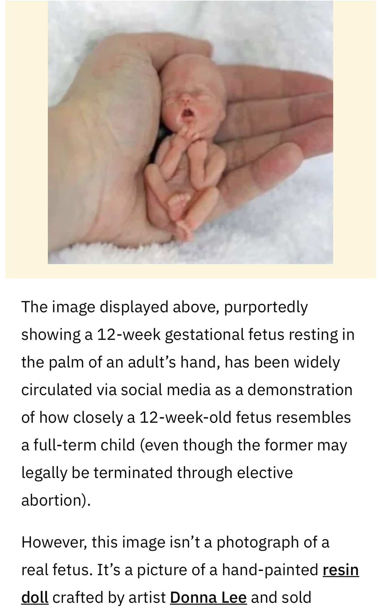 Real fetus