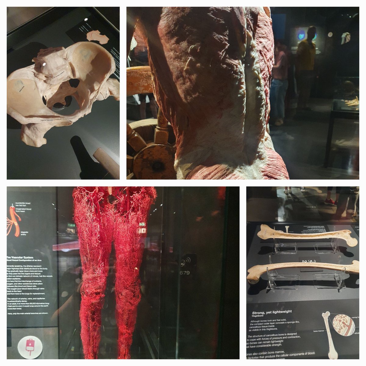 rhi87griffiths's tweet photo. Bit of an anatomy refresh #bodyworld #amsterdam #culturaltrip https://t.co/gFx301nYlZ