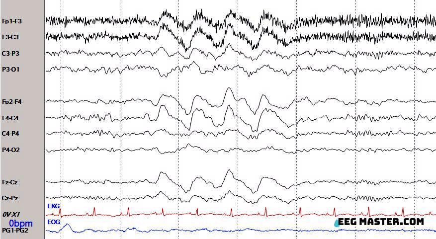 EEG Master (@eeg_master) on Twitter photo 