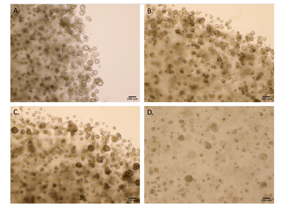 adbeggs's tweet image. Congrats to Agata @LadySciencee from @beggs_lab for passing her thesis with minor corrections! Thanks also to Dion Morton, Tim Maughan from @UniofOxford and Deena Gendoo for chairing! 

Agata started the work in our lab on radiosensitivity and organoids: