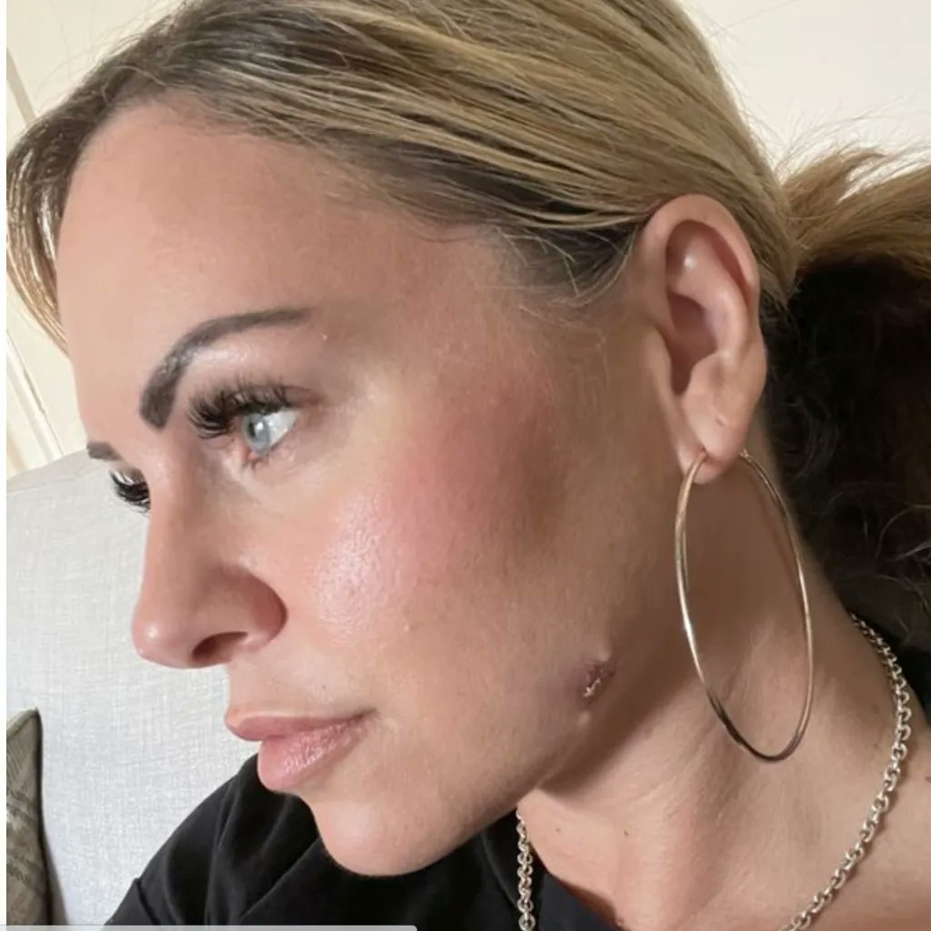 Melanoma Research tweet media