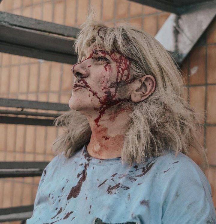 Two rockets hit one of the enterprises in #Zaporizhzhia on the afternoon of July 13. 

At the moment, 7 victims are confirmed.

Pictures of injured: Zaporizka Sich 
#RussiaIsATerroristState #UkraineUnderAttack