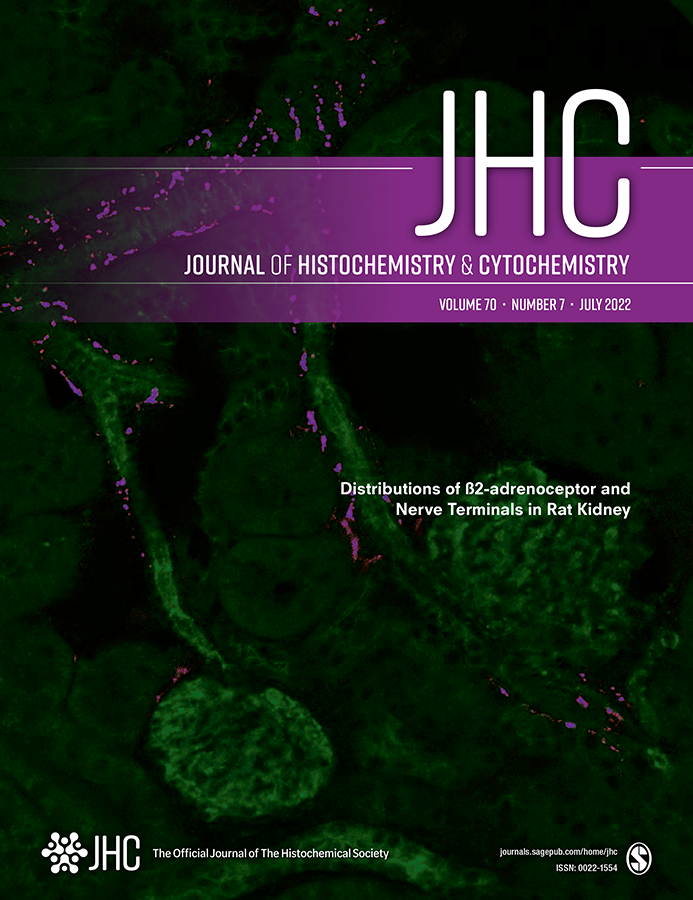 JHCnews's tweet photo. The new July 2022 issue of JHC is now available online!
Check out the latest articles at https://t.co/F1yh4pvhtp
#Science #Histochemistry #Cytochemistry https://t.co/NGGBAmupiQ