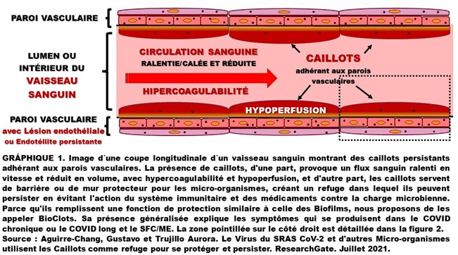 Aguirre1Gustavo's tweet image. Les Fibrinolytiques sont spécifiques pour dégrader la Fibrine des #BioClots
qui protègent le virus et leur créent un refuge
(voir document lien)
En #COVIDlong il est recommandé de les prendre avec des Antiplaquettaires + médicaments contre la Charge Virale
researchgate.net/publication/35…