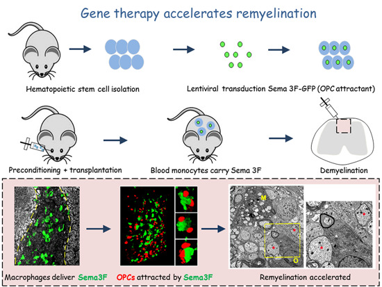 Cell Therapy News (@celltherapynews) on Twitter photo 📢 New in <a href="/EmboMolMed/">EMBO Mol. Medicine</a>!
A study led by Dr. Vanja Tepavčević (<a href="/TepavcevicVanja/">Vanja Tepavcevic</a>) provides proof of concept that #BloodCells can be used to deliver pro-remyelinating agents “at the right time and place”. ⏰
Read the paper: bit.ly/3z3q3OA 📢 New in <a href="/EmboMolMed/">EMBO Mol. Medicine</a>!
A study led by Dr. Vanja Tepavčević (<a href="/TepavcevicVanja/">Vanja Tepavcevic</a>) provides proof of concept that #BloodCells can be used to deliver pro-remyelinating agents “at the right time and place”. ⏰
Read the paper: bit.ly/3z3q3OA