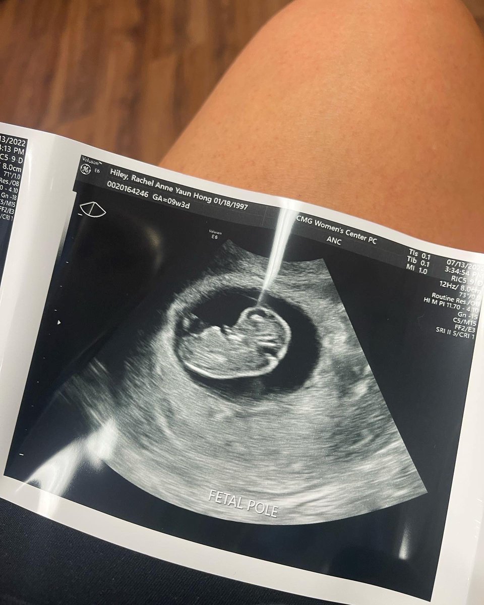 Jonathan Hiley tweet media