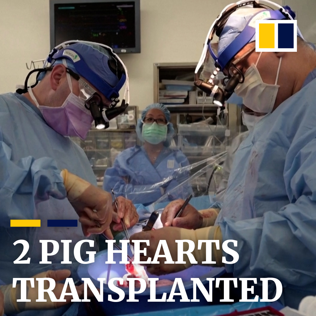 Surgeons at New York University have successfully transplanted