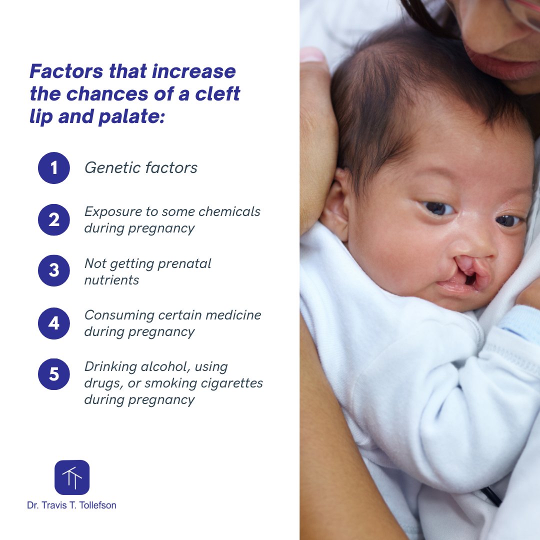 While most medical professionals agree that there is no single reason that causes cleft lip and palate, there are many factors that may contribute to their development. ​#drtravistollefson #cleftlipandpalateawareness #cleftlipawareness