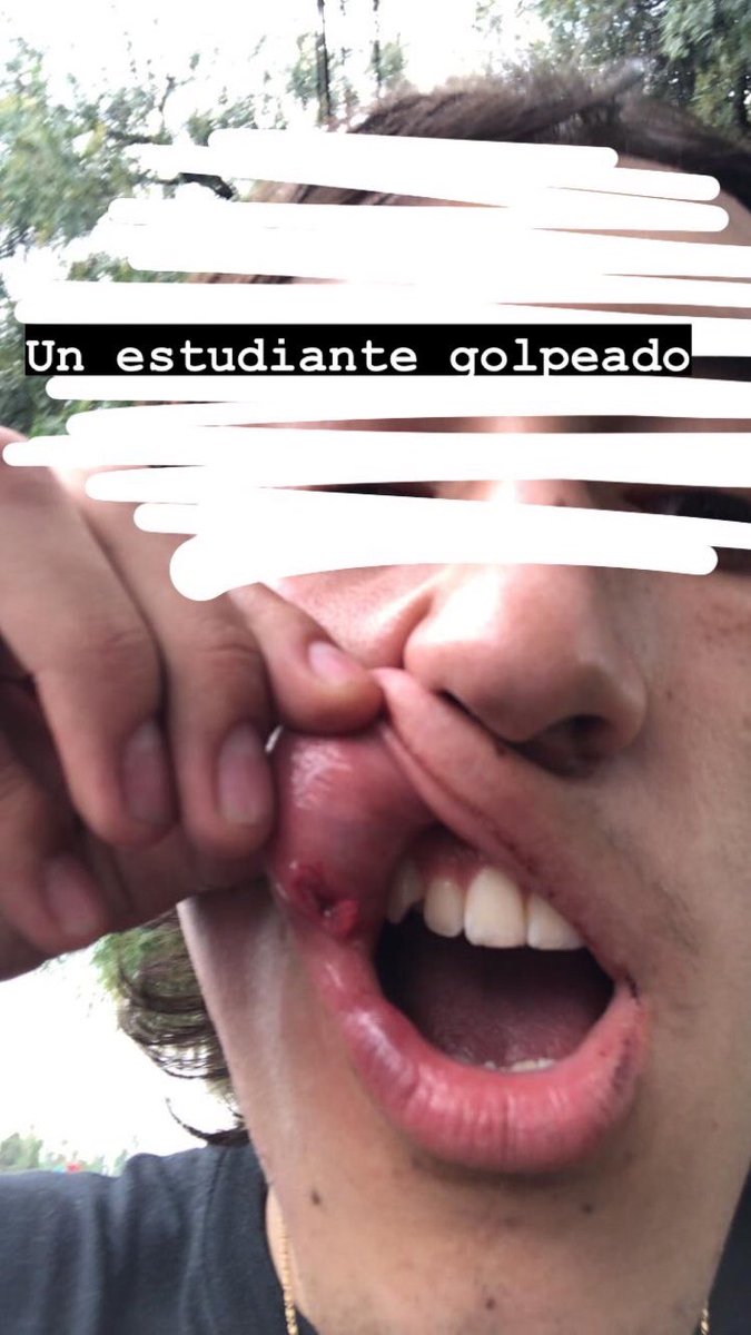 leotomasx's tweet photo. Evidencia adjunta https://t.co/RXVu7QMgMh