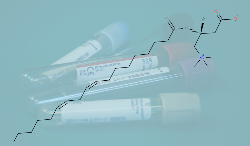 lipidmaps's tweet photo. More and more papers reporting advances in methodology of the use of lipid analyses in diagnostics are published. In #LIpidMatters, Bill Christie hopes they make it to the clinic.
https://t.co/xR8CUlXL7b https://t.co/qMEfZnEOSb