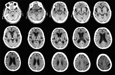Test Psicològic: Habilitats Neuropsicològiques de Gènere

<a href="/ARC_CESIRE/">ARC</a> <a href="/cesirecat/">CESIRE</a> <a href="/oscarsj82/">Òscar Sánchez</a> 
apliense.xtec.cat/arc/node/31217