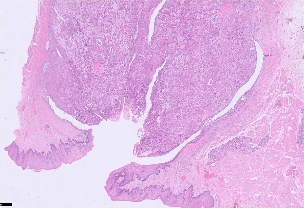 Oral Path Opinion tweet media