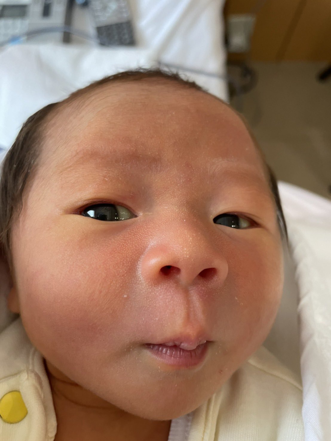 تويتر にゃんず 38w 2m على تويتر 新生児黄疸が出てしまいましたが当初の予定通り 本日無事に退院できました リプ返し出来てなく申し訳ありませんが 本当にちゃんと読ませていただき 入院中の励みになりました 我が家のあにまるず Amp 天使を皆さまが