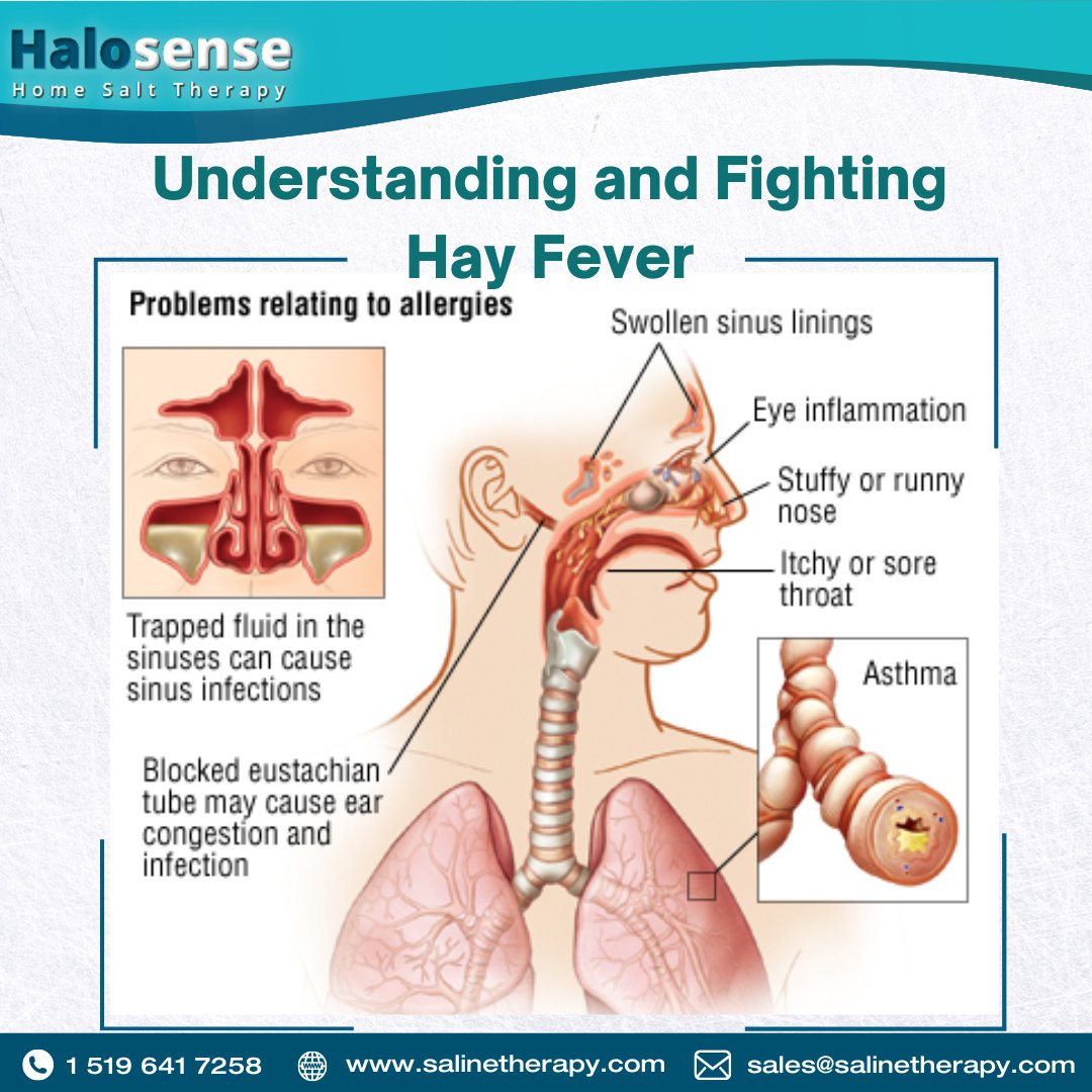 HomeSaltTherapy's tweet photo. #HayFever affects your #Sinuses. Fluids get trapped in the sinus and cause inflammation, itchiness, and soreness.
Severity can even lead to #Asthma.
#SalineTherapy is one of the best remedies to cure  and prevent #HayFever.
👉https://t.co/QwnE6YmDPc
#HomeSaltTherapy #SaltTherapy https://t.co/eh2GJr0GP4