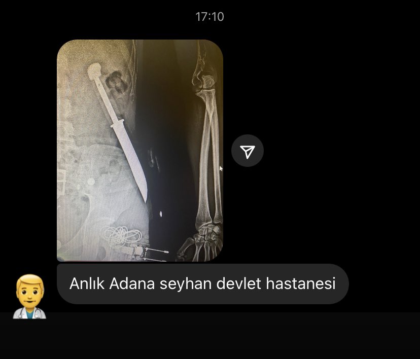 Bir meslektaşımdan geldi,
anlık Adana Seyhan Devlet Hastanesi’nden…