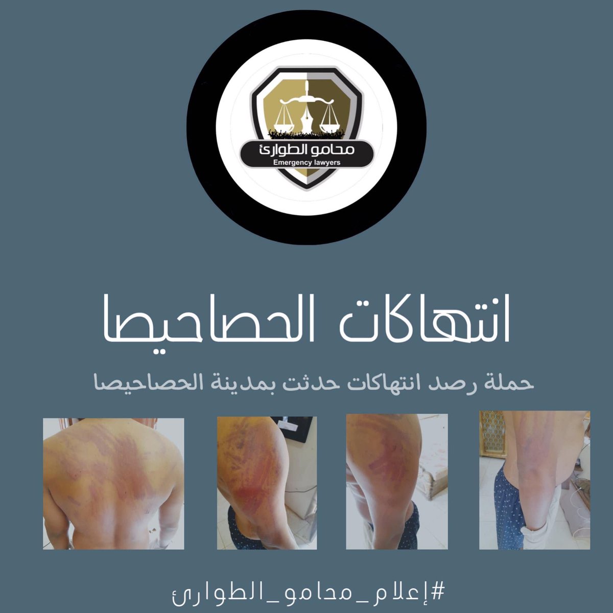 Nmhali's tweet photo. @EmergncyLawyers issued a statement regarding #SudanCoup forces #HumanRights violations against residents of Al-Hasahiesa, Al-Gezira state.
They mentioned:
1) 70+ civilians were arrested & fined during #June30March 👉🏼
#Sudan #Sudanese
#KeepEyesOnSudan
https://t.co/6XpZfCfiJ7 https://t.co/8H3lbnjJdq