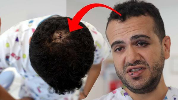 Doktor doktoru dövdü.

Gaziantep'te diş hekimi Atalay Gençel, meslektaşı Onur B. tarafından darbedilip yerde sürüklendi. Olay güvenlik kamerasına yansırken, yüzünde morluklar oluşan Gençel, "Meslektaşım tarafından darbedilmek üzücü.
#Gaziantep'te
#SagliktaSiddet
#sağlıkbakanlığı