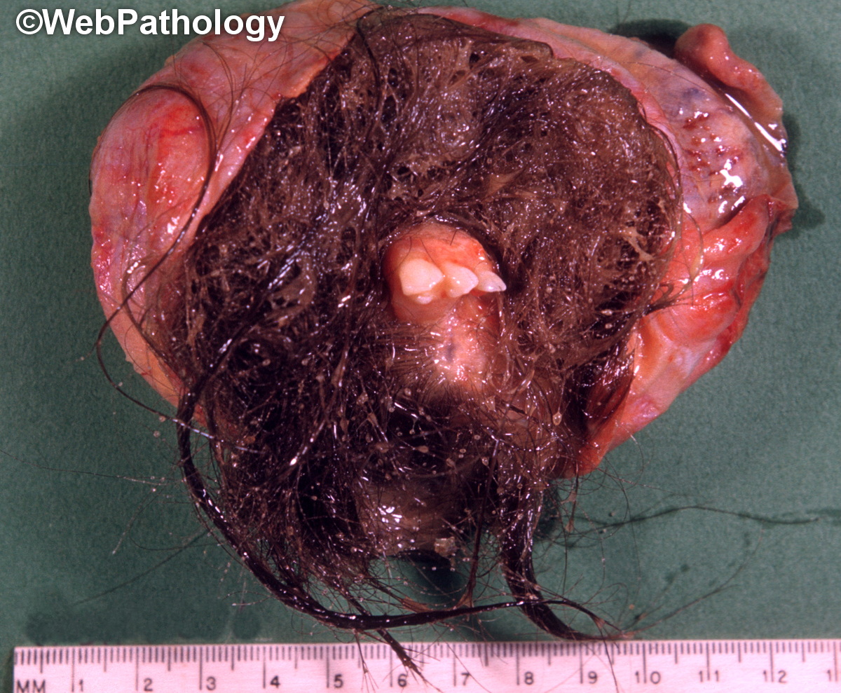 WebPathology on Twitter: WebPathology on Twitter: