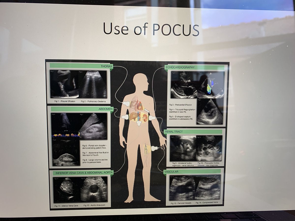 AcutemedSarbc's tweet photo. Thankyou @RCPLondon @DrAlGilmore for asking me to speak at this brilliant conference #CalltheMedReg @RCPhysicians @RCPL_trainees inspiring and empowering the future physicians on the Power Of POCUS - a core skill for all specialists and generalists! @GeneralistUS @acutemedicine https://t.co/wcXiY2OmZJ