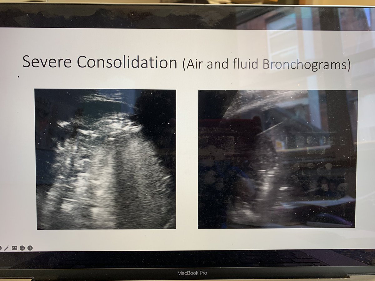 AcutemedSarbc's tweet photo. Thankyou @RCPLondon @DrAlGilmore for asking me to speak at this brilliant conference #CalltheMedReg @RCPhysicians @RCPL_trainees inspiring and empowering the future physicians on the Power Of POCUS - a core skill for all specialists and generalists! @GeneralistUS @acutemedicine https://t.co/wcXiY2OmZJ
