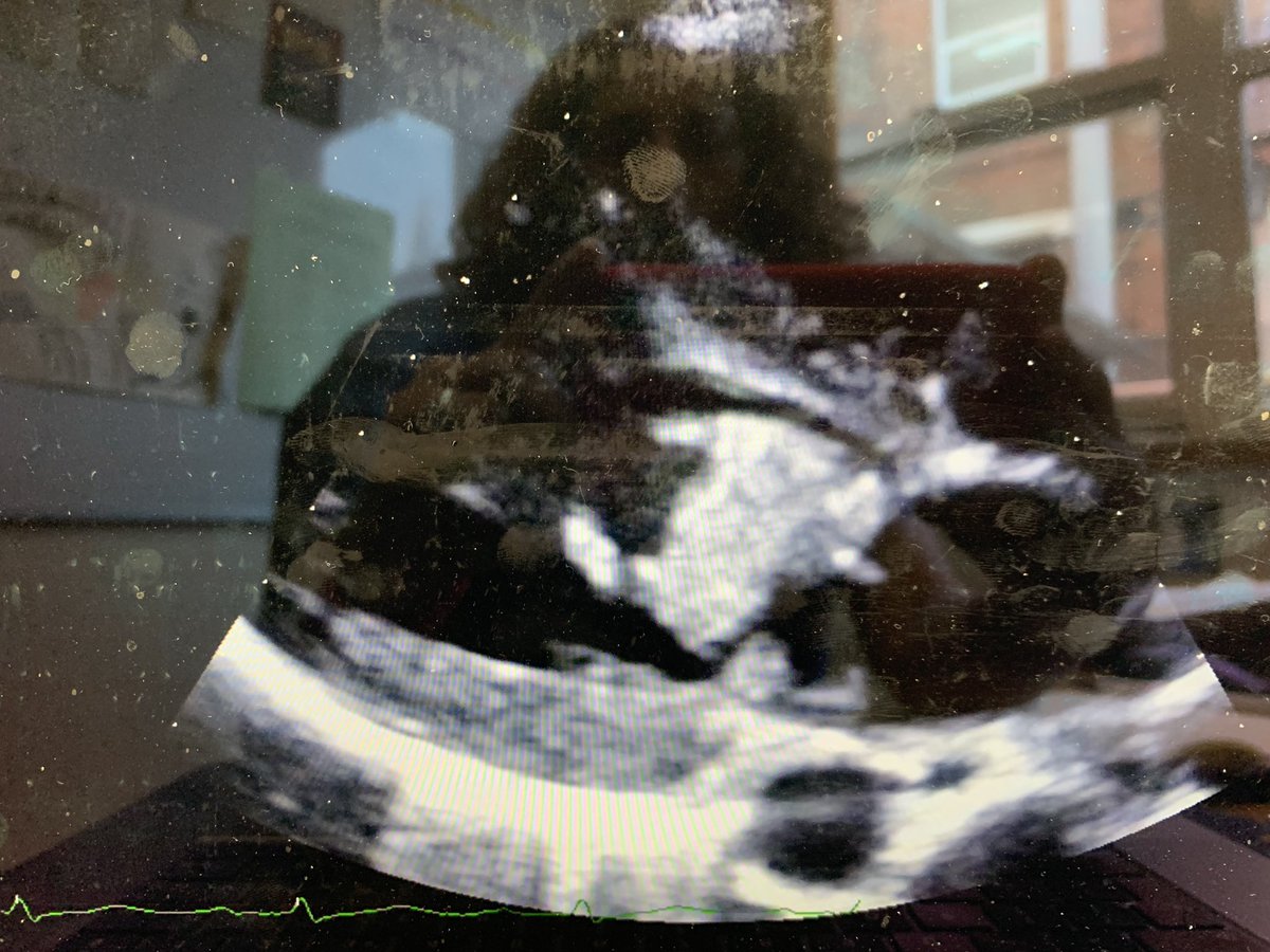 AcutemedSarbc's tweet photo. Thankyou @RCPLondon @DrAlGilmore for asking me to speak at this brilliant conference #CalltheMedReg @RCPhysicians @RCPL_trainees inspiring and empowering the future physicians on the Power Of POCUS - a core skill for all specialists and generalists! @GeneralistUS @acutemedicine https://t.co/wcXiY2OmZJ