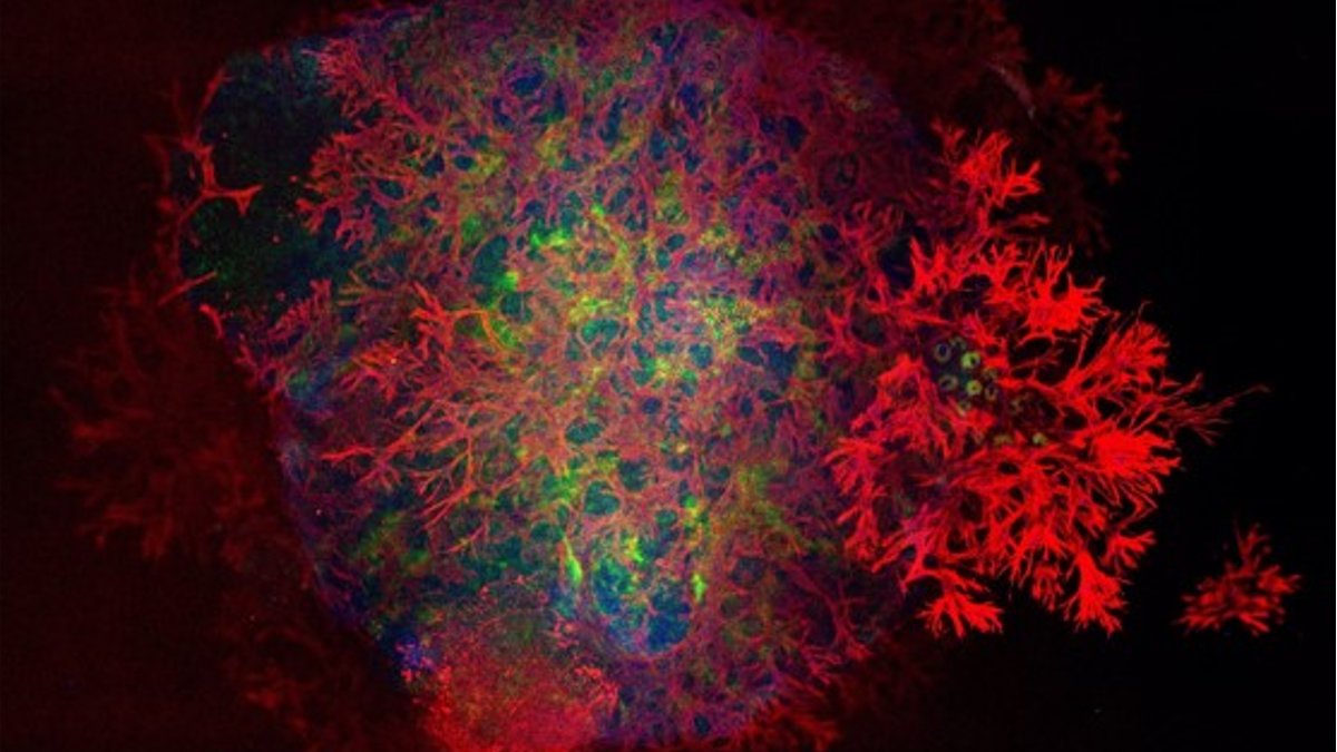 columbiacancer's tweet photo. Five Columbia research teams have been awarded 2022 Precision Medicine Pilot Grants to advance the fields of cardiovascular disease, colorectal cancer, rare disease, organ transplant, and precision psychiatry.

Explore our winning projects below: https://t.co/2UP50V4MWM https://t.co/F5obFq4fhq