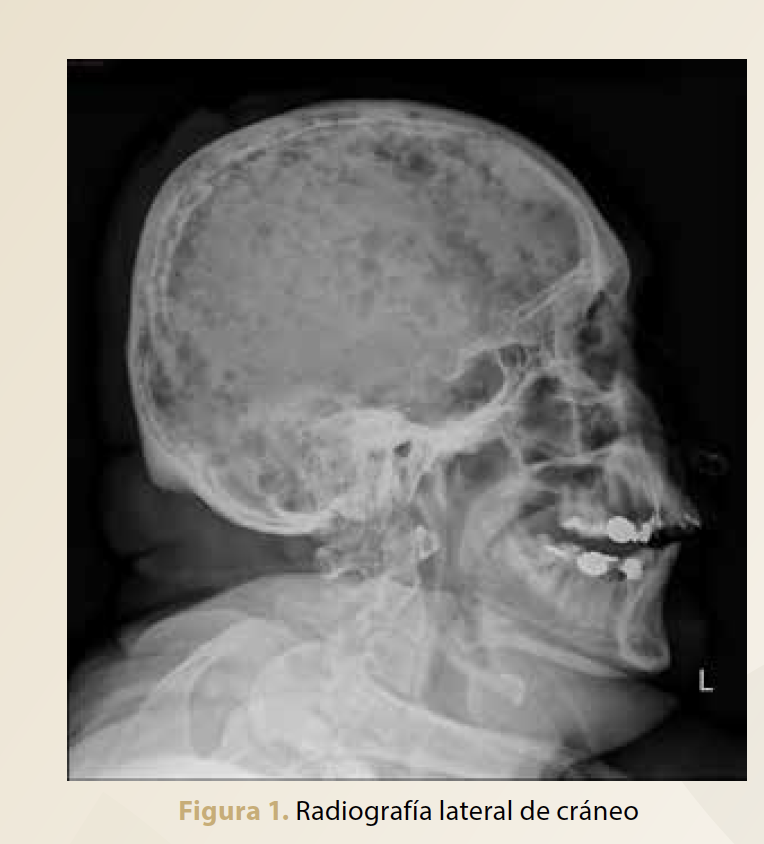facmed_unam's tweet photo. Haga su diagnóstico: Paciente del sexo masculino de 68 años con dolor constante de más de 6 meses de evolución en la región lumbar, anemia, elevación de la creatinina sérica, proteinuria y elevación del calcio sérico ¿cuál es tu sospecha diagnóstica? 👉https://t.co/0JMc2NKeyy https://t.co/1d5QFDu7Ti