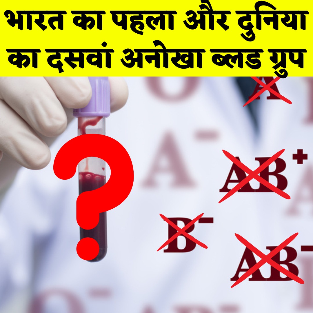 YouThinkHindi's tweet photo. 👇Click here👇watch full video
https://t.co/8k7bQmxacr
#emm
#EMMbloodGroup https://t.co/q3fszABfHP