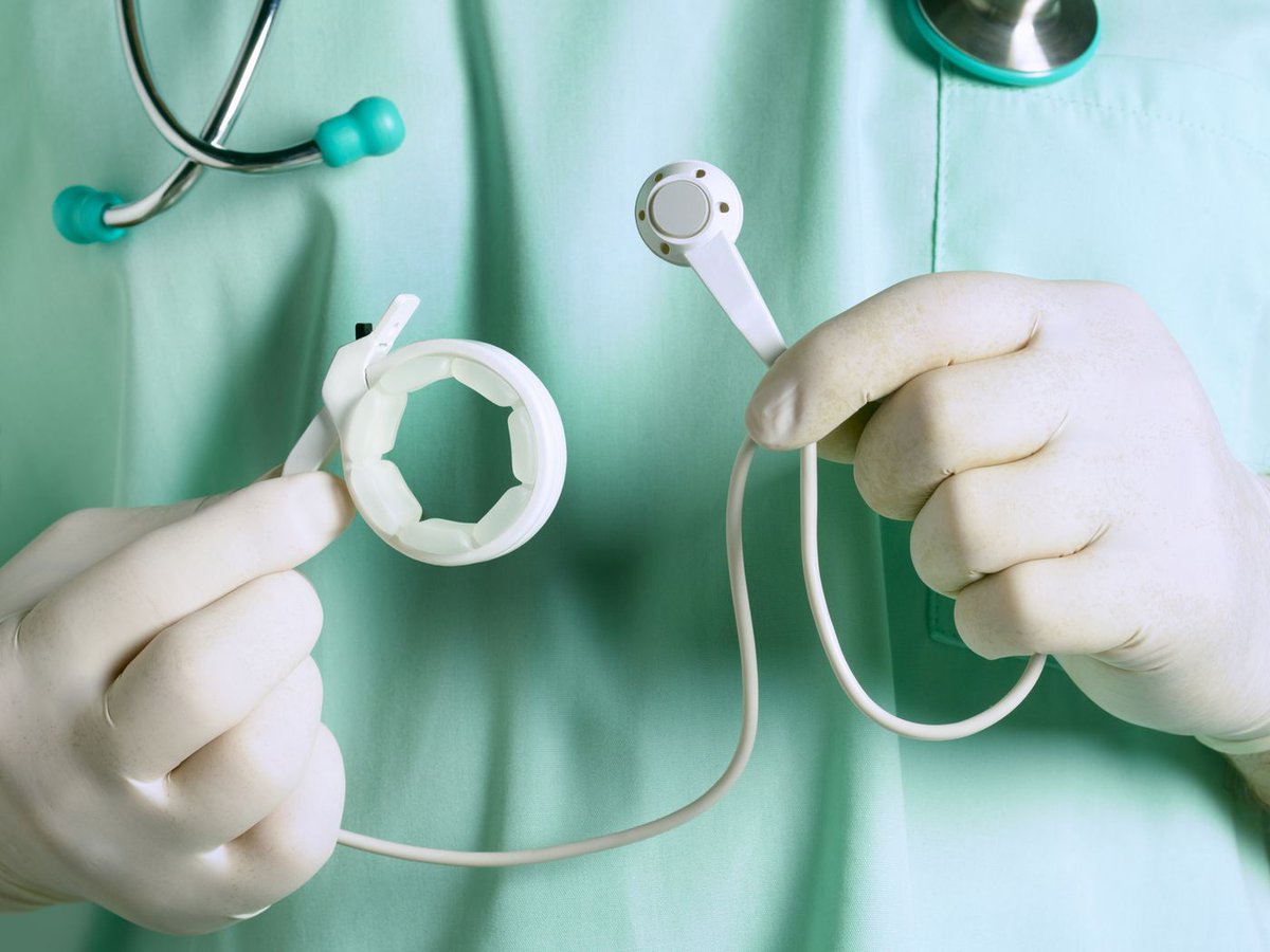 Web: …hthalmology.peersalleyconferences.com
Weight loss with bariatric surgery cuts the risk of developing cancer and death from cancer #Scleritis #Uveitis #Inflammation #OcularOncology #pathology #biochemistry #VitreousDisorders #lensdisorder #retina #cellbiology #Immunology #pathophysiology