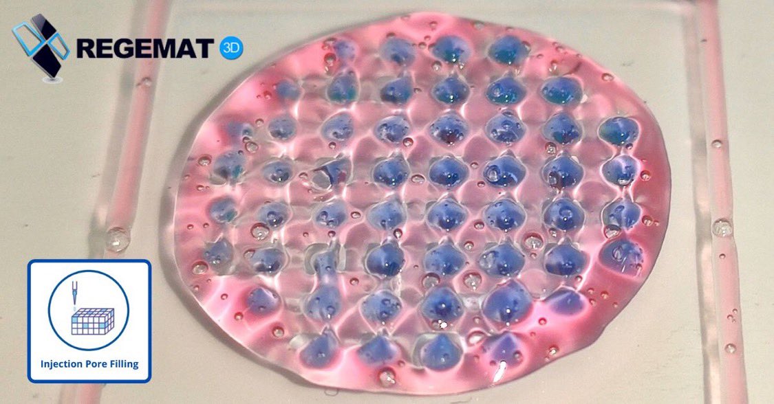 josbaema's tweet photo. Another nice printing using @REGEMAT3D #IPF
#bioprinting #REG4Life https://t.co/1OGlpE8AMM