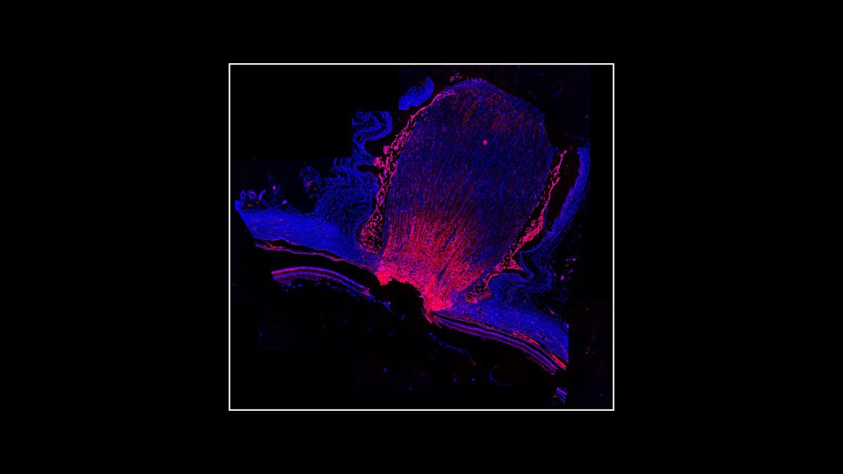 NIH Common Fund (@nih_commonfund) on Twitter photo .<a href="/_hubmap/">Human BioMolecular Atlas Program (HuBMAP)</a> researcher Dr. Angela Kruse asks you to set your sights on this #immunfluorescence image of the optic nerve. Just a reminder to take care of your eyes, because that’s how eye roll.😉 #WomenInScience #ScienceImages #AxioScan <a href="/SpragginsLab/">Spraggins Lab</a> .<a href="/_hubmap/">Human BioMolecular Atlas Program (HuBMAP)</a> researcher Dr. Angela Kruse asks you to set your sights on this #immunfluorescence image of the optic nerve. Just a reminder to take care of your eyes, because that’s how eye roll.😉 #WomenInScience #ScienceImages #AxioScan <a href="/SpragginsLab/">Spraggins Lab</a>