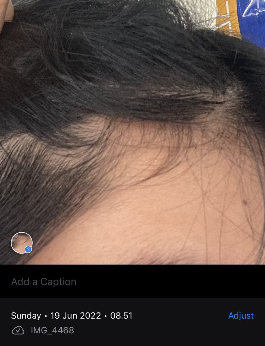 maharanilyss's tweet photo. Treatment buat masalah rambut rontok

a thread

         from this                      to this https://t.co/oxnUUtG0uk