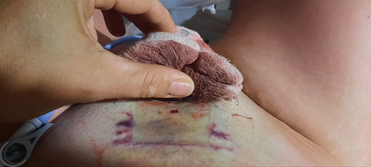 CricriSubie's tweet photo. Enfin une femme à cent pour cent il faut souffrir pour être belle qu'est-ce que vous en dites https://t.co/w1lKIduqn0