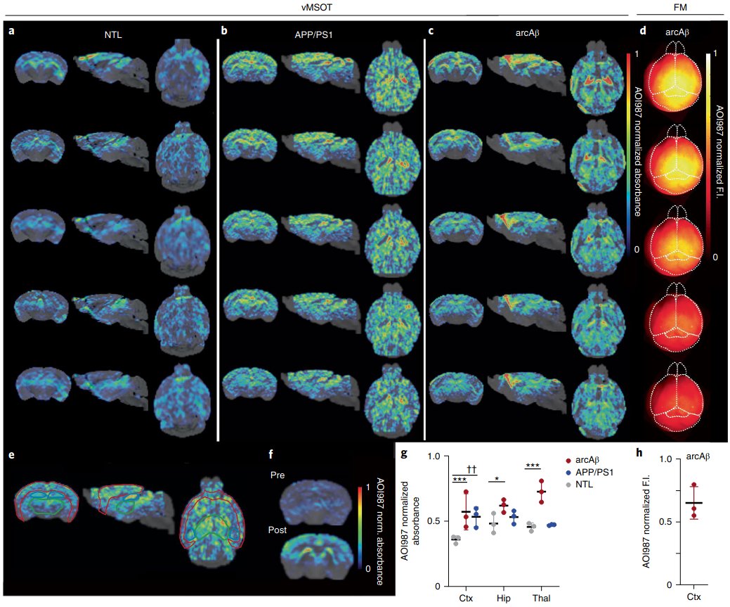 📢 2nd #mesoSPIM paper alert in 2 days! 📢 An multimodality tour de force by @RuiqingNi @Razanskylab @Jan_Klohs @AdrianoAguzzi visualizing #Alzheimer plaques in & ex vivo with #optoacoustic & #multifocal & #lightsheet & #multiphoton #Microscopy: nature.com/articles/s4155…