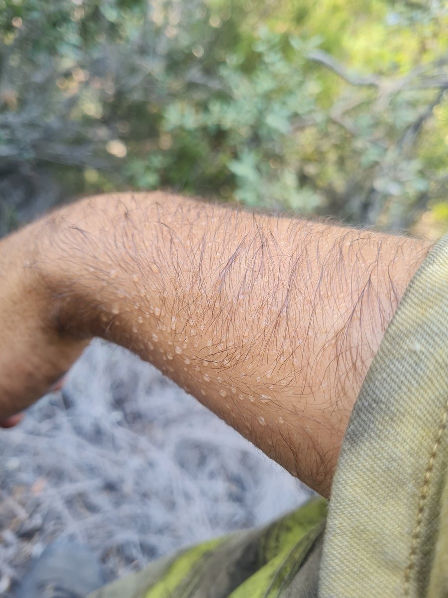 ivandlg99's tweet photo. Así responde el cuerpo a las temperaturas de un incendio forestal. https://t.co/gEpypafrgv