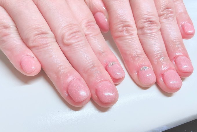 深爪矯正のtwitterイラスト検索結果