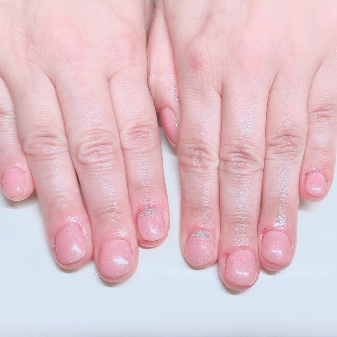 深爪矯正のtwitterイラスト検索結果